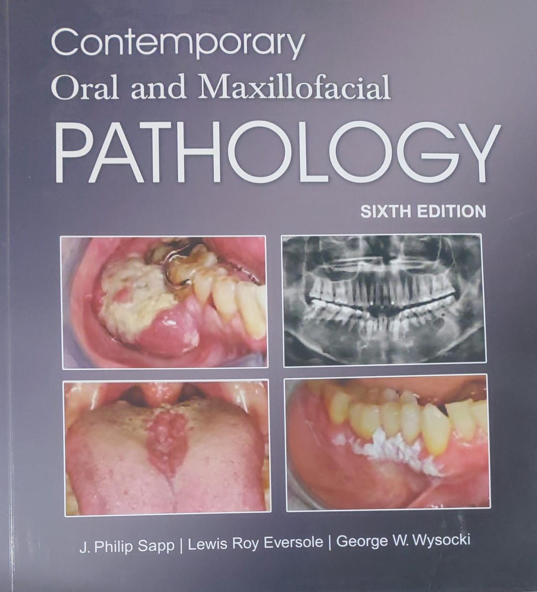 Contemporary Oral and Maxillofacial Pathology