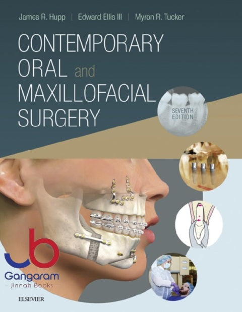 Contemporary Oral And Maxillofacial Surgery (7th Edition)